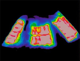 exo2�@�G�N�\�c�[�@�X�g�[�����C�_�[�@�x�X�g